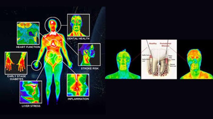 Dental-Medical Thermography